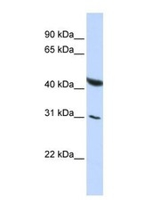 NBP1-57256 - BRUNOL6 / CELF6