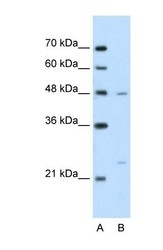 NBP1-70421 - BSDC1