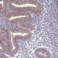 NBP1-82204 - BSPRY