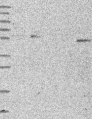 NBP1-81815 - BTBD10