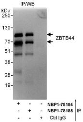 NBP1-78185 - BTBD15 / ZBTB44