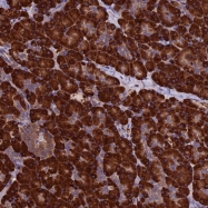 NBP1-84214 - BTBD3