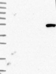 NBP1-84215 - BTBD3