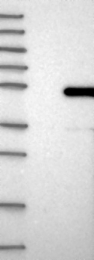 NBP1-88672 - BTBD6 / BDPL