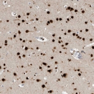 NBP1-89924 - BCLAF1 / BTF
