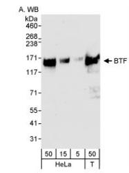 NB100-1704 - BCLAF1 / BTF
