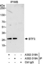NBP1-28700 - BTF3