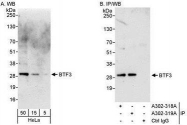 NBP1-28716 - BTF3