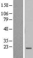 NBL1-08046 - BTF3L4 Lysate