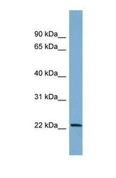 NBP1-58173 - BTG4