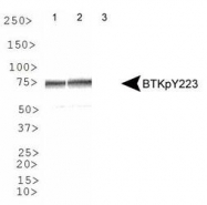 NBP1-78295 - BTK