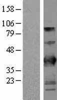 NBL1-08054 - BTN3A2 Lysate