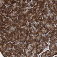 NBP1-88516 - BUB1A