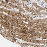 NBP1-83285 - BVES