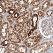 NBP1-88698 - Bcl-2-like 8