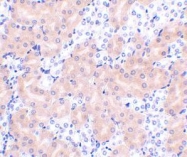 NBP1-76406 - Bcl-2-like 5