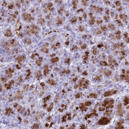 NBP1-91699 - Bestrophin-2