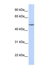 NBP1-59007 - Beta-1 adrenergic receptor