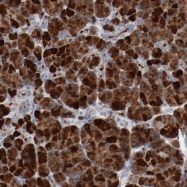 NBP1-90227 - Beta-2 adrenergic receptor