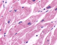NLS2656 - Beta-2 adrenergic receptor