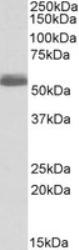 NB600-978 - Beta-1 adrenergic receptor