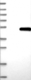 NBP1-84971 - Biglycan
