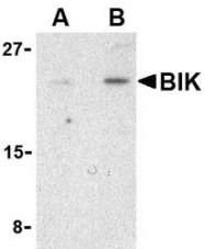 NBP1-76704 - BIK