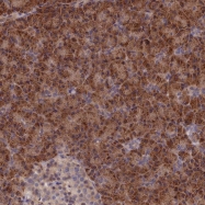 NBP1-90757 - Biliverdin reductase A