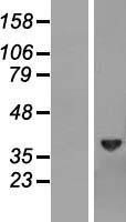 NBL1-07993 - Biliverdin Reductase Lysate