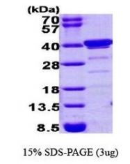 NBP1-30216 - Biliverdin reductase A