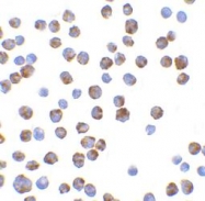 NBP1-77118 - Bcl-2-like 11