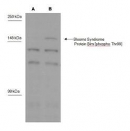 NBP1-46851 - BLM