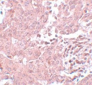 NBP1-77125 - BCAS3 / GAOB1
