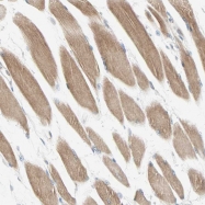 NBP1-89992 - Brevican core protein