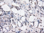 NBP1-47680 - BUB1B