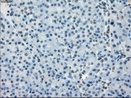 NBP1-47680 - BUB1B