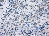 NBP1-47680 - BUB1B
