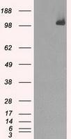NBP1-47680 - BUB1B