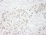 NB100-55254 - BUB1B