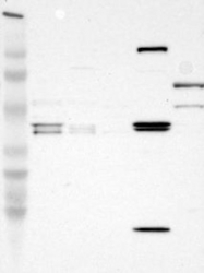 NBP1-84070 - DNAAF2 / KTU