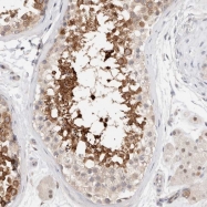 NBP1-81295 - C17orf97