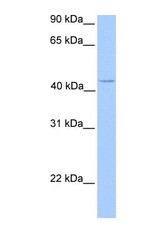 NBP1-70443 - C17orf97