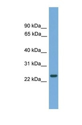 NBP1-70444 - C19orf18