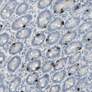 NBP1-81096 - EAN57 / C22orf33