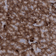 NBP1-88270 - GCNT4