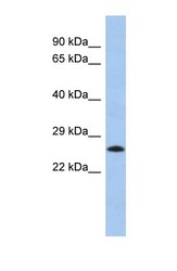 NBP1-56812 - C2orf27