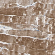 NBP1-84911 - Augurin