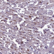 NBP1-91729 - C2orf62