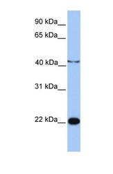 NBP1-70469 - C2orf68