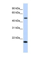 NBP1-70474 - C5orf55